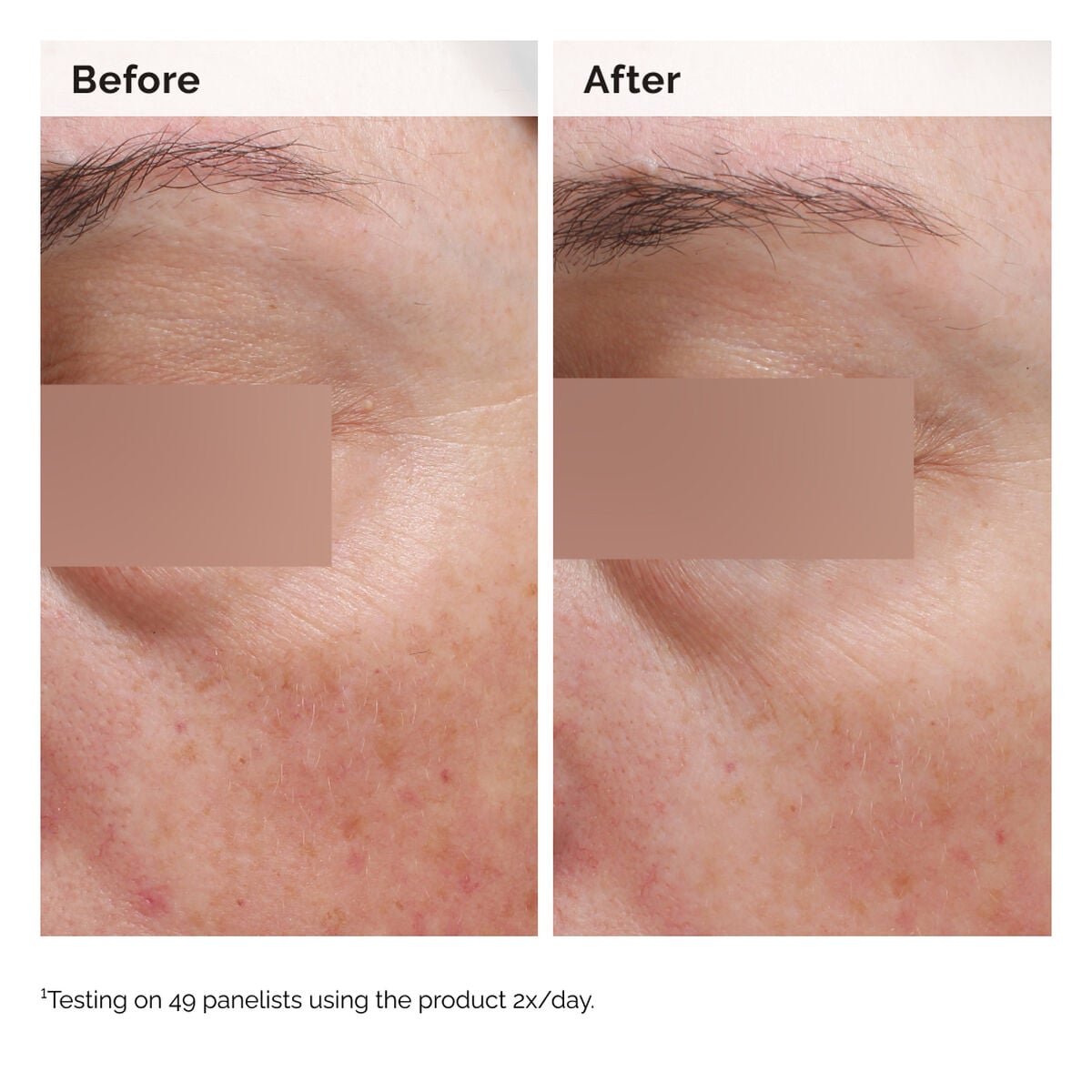 niacinamide-5-face-and-body-emulsion-l0 2024-08-23-ORD-Nia-5pct-Face-Body-B-A-Elasticity-Global-02-1x1.jpg