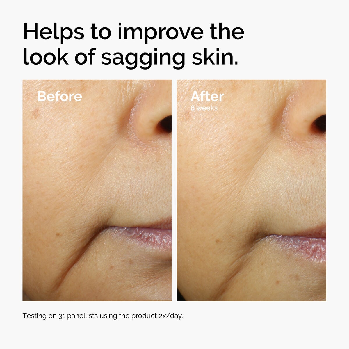 caffeine-3-escin-1-face-serum-l7 ord-caffeine-3pct-escin-1pct-face-serum-before-after-sagging.jpg