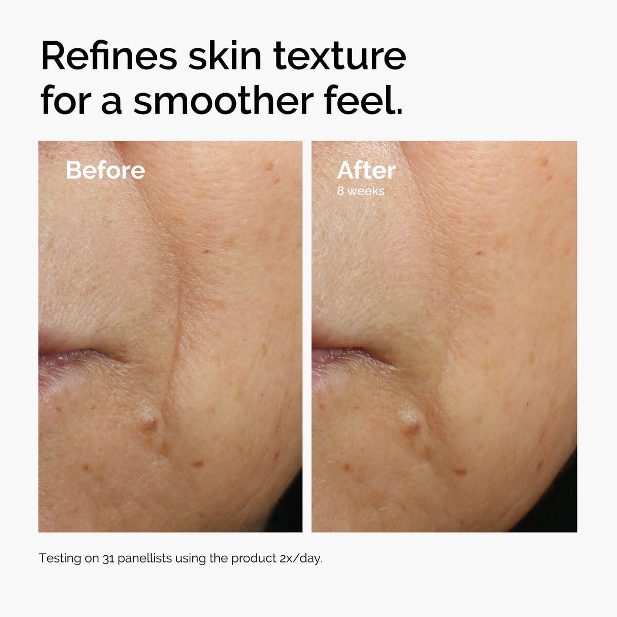 caffeine-3-escin-1-face-serum-l7 ord-caffeine-3pct-escin-1pct-face-serum-before-after-texture.jpg