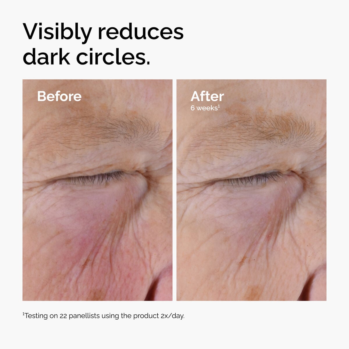 caffeine-solution-5-egcg-eye-serum-q2 ord-caffeine-solution-egcg-dark-circles-before-after.jpg