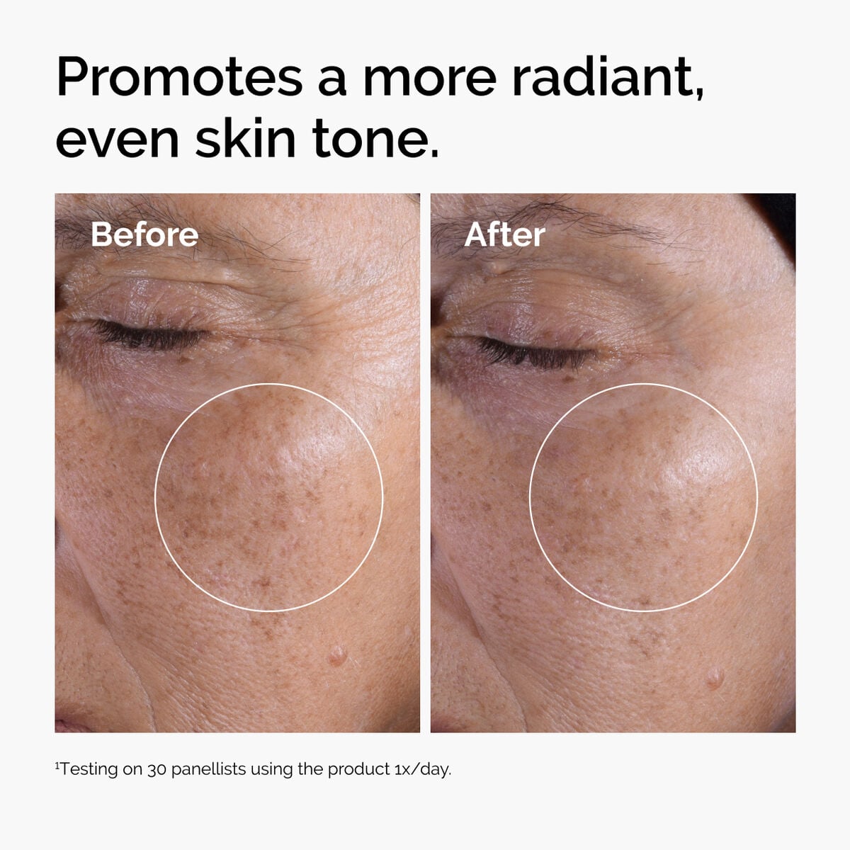 glycolic-acid-7-exfoliating-toner-q1 ord-glycolic-before-after-radiance.jpg