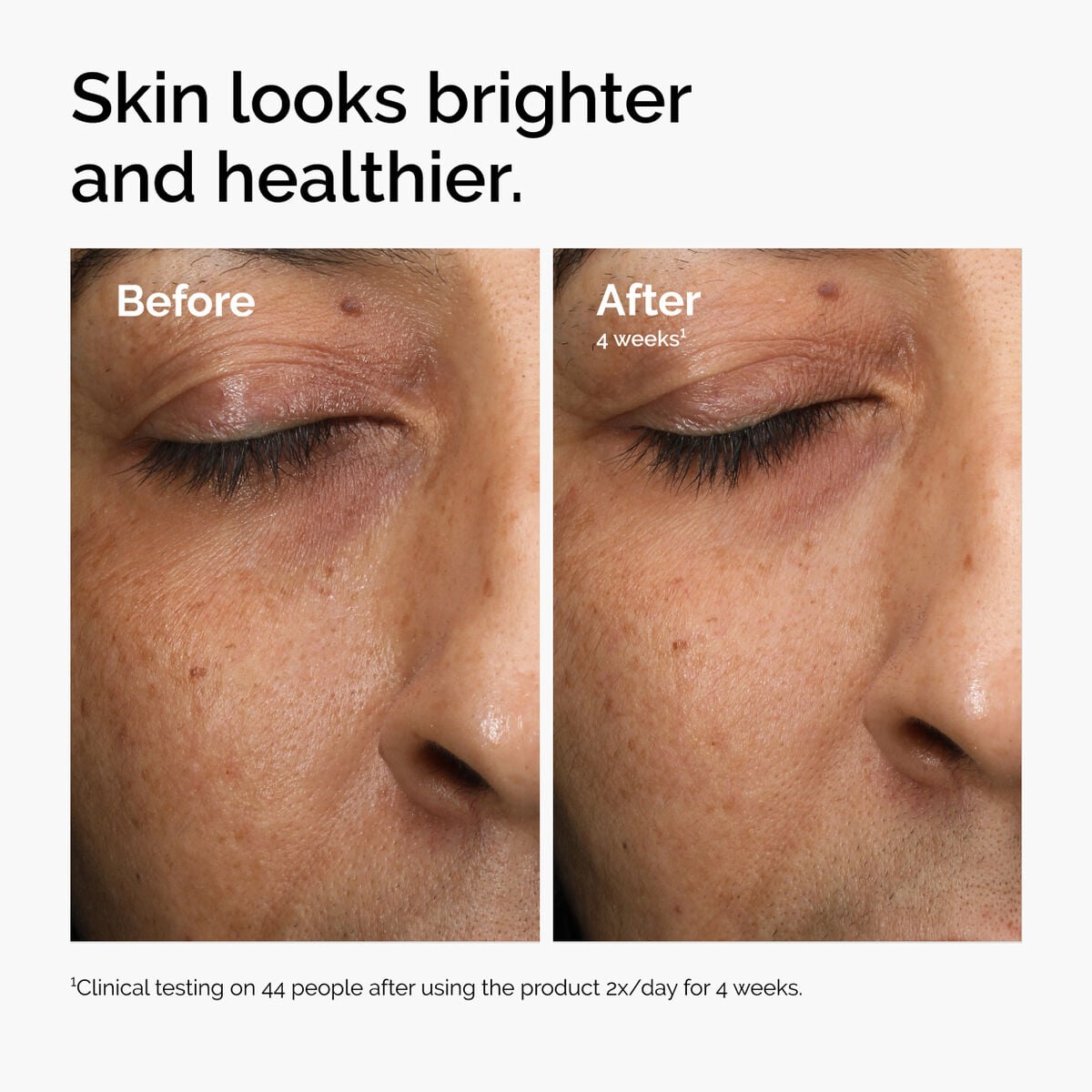 multi-antioxidant-radiance-serum-r2 ord-mars-before-after-healthy.jpg
