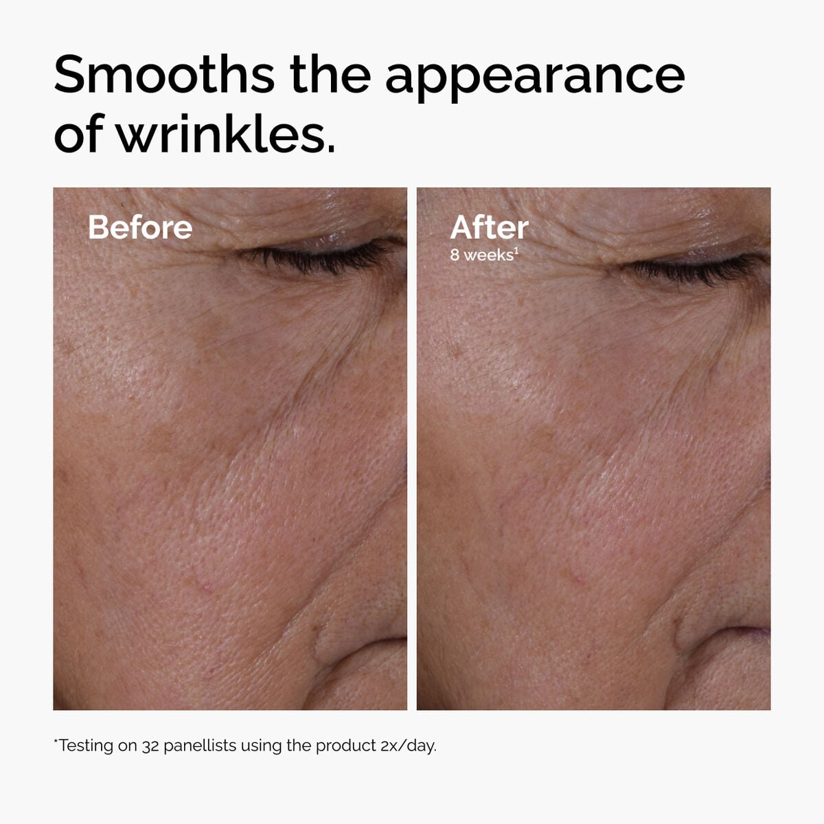 multi-peptide-ha-serum-s4 ord-multi-peptide-ha-serum-wrinkles-before-after.jpg