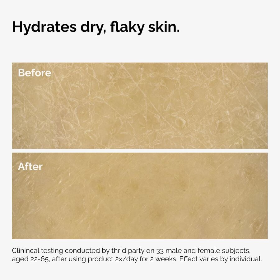 the-body-care-collection-f9 ord-natural-moisturizing-factors-inulin-body-before-after-graphic-02.jpg