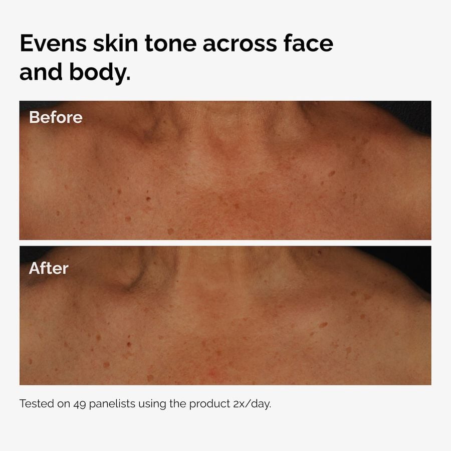 the-body-care-collection-r0 ord-niacinamide-face-body-serum-before-after-even-tone-graphic.jpg