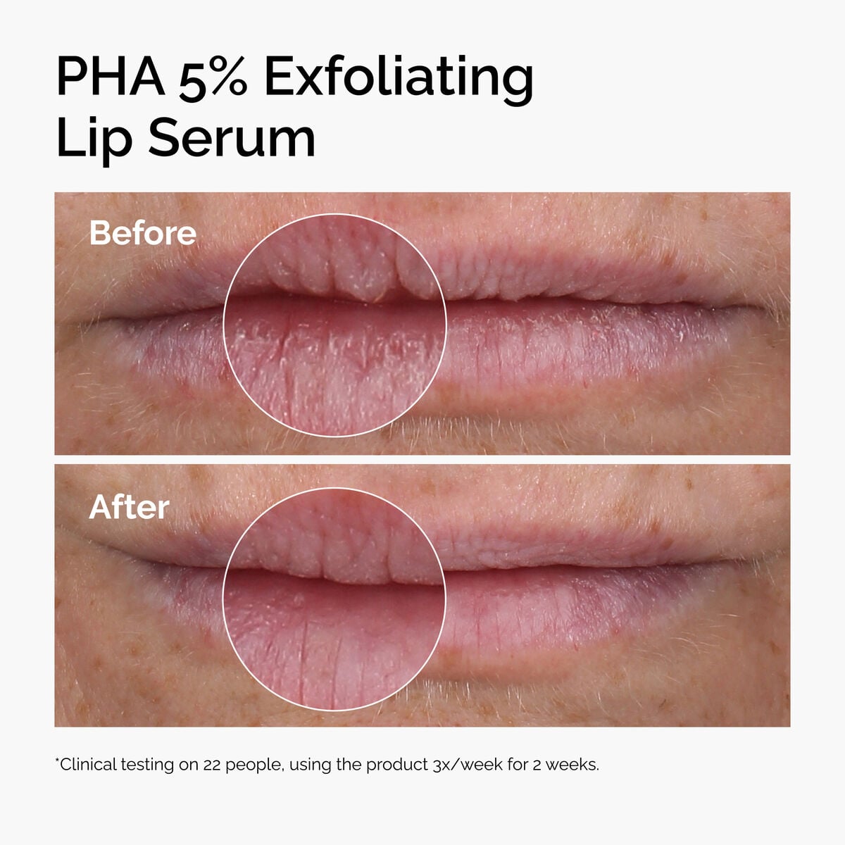 pha-5-exfoliating-lip-serum-v2 ord-pha-5pct-lip-exfoliating-serum-before-after.jpg