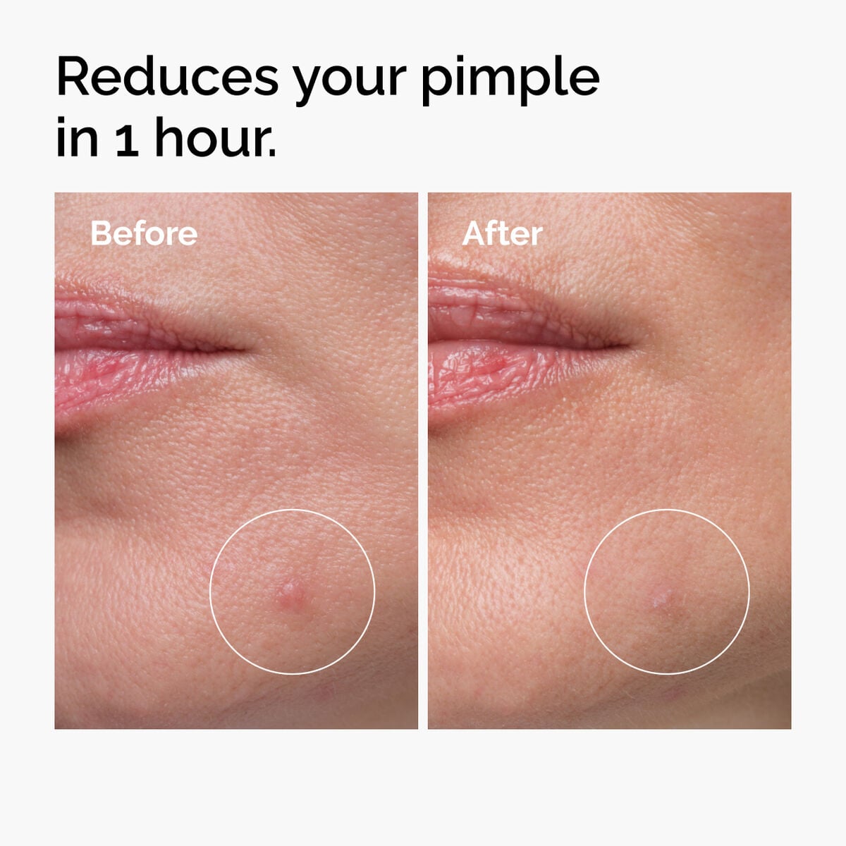 sulfur-10-powder-to-cream-concentrate-m8 ord-sulfur-10pct-powder-to-cream-concentrate-before-after-NA.jpg